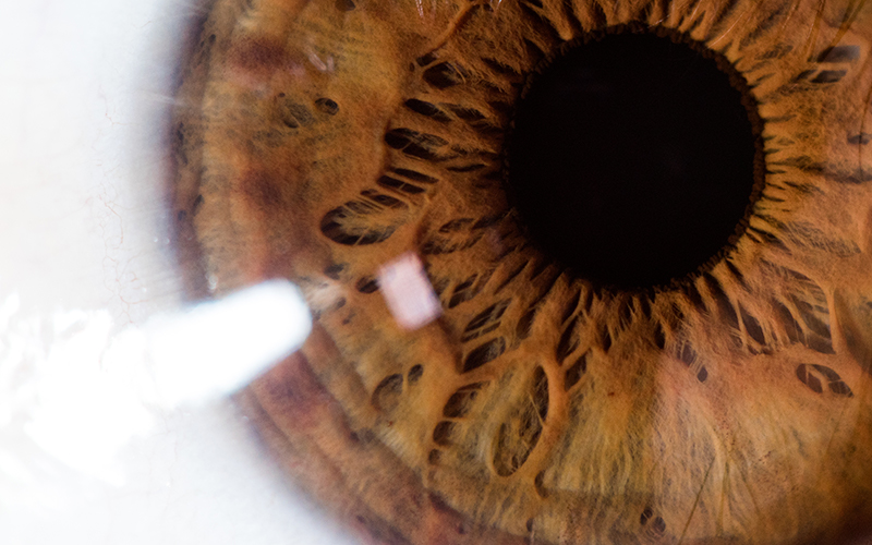 Neuro Ophthalmology